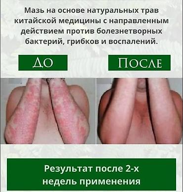шибари мазь: Мазь китайская травяная «Сокровище рыбака» Мазь «Сокровище рыбака» — 2