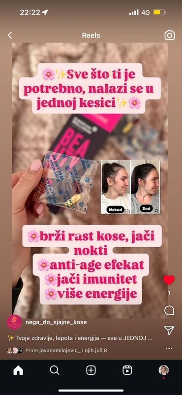 aplikator za sociva: 💇‍♀️ BEAUTY BOX ZA KOSU – TVOJA KOSA, TVOJA MOĆ! 💇‍♀️ Reci ZBOGOM