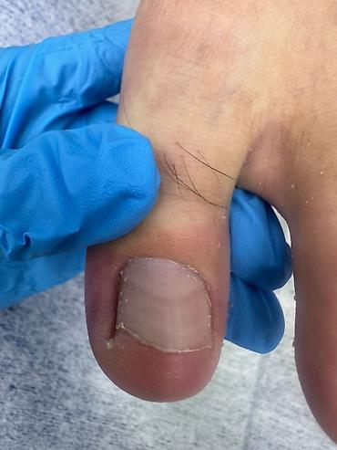 Маникюр: Коррекция вросших ногтей, Маникюр, Педикюр, Услуги подолога, С выездом на дом, Консультация, Одноразовые расходные материалы — 1