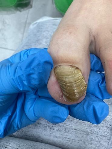 Маникюр: Коррекция вросших ногтей, Маникюр, Педикюр, Услуги подолога, С выездом на дом, Консультация, Одноразовые расходные материалы — 15