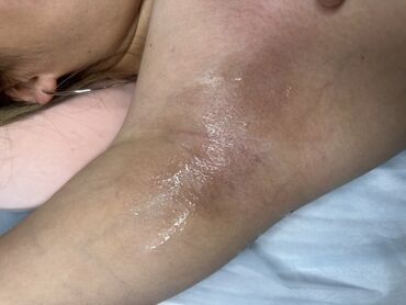 Эпиляция: Я мастер Ася 🍯 С опытом 3 года 🤝 Шугаринг Ламинирование бровей и — 7