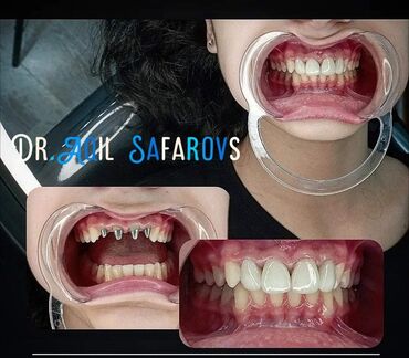 Stomatologiya: 💫Ramazan ayı ilə əlaqədar Kampaniya✨🌟⭐💫 🌊🔥Diş Həkimi 🔥🌊 Qiymətləri — 8