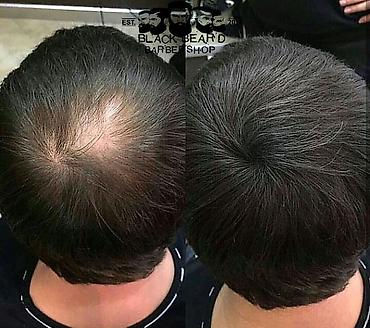 sac kraskası: Saç xətti və dib boyası üçün kompak pudra Məhsul: VERONNI / VOLLUCK — 3