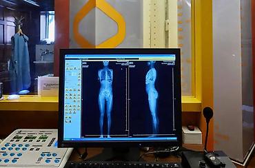 био электро массаж: Усталость, нет энергии, проблемы со сном, набор веса, частые простуды — 2