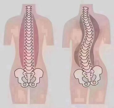 массажист в бишкеке: Массаж | Лечебный массаж | Разница длины ног | С выездом на дом, Консультация