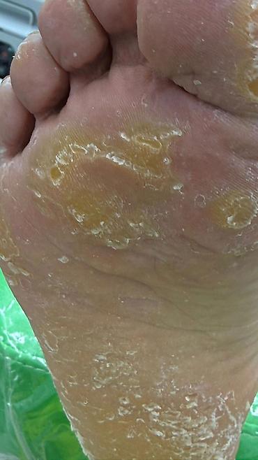 Маникюр: Коррекция вросших ногтей, Маникюр, Педикюр, Услуги подолога, С выездом на дом, Консультация, Одноразовые расходные материалы — 11