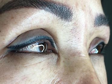 Косметология: Косметология, Ботокс, Биоревитализация, Ботулинотерапия, С выездом на дом, Консультация, Гипоаллергенные материалы — 5