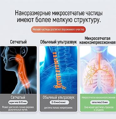 Ингаляторы, небулайзеры: Компрессорный ингалятор небулайзер Микронное распыление — 2