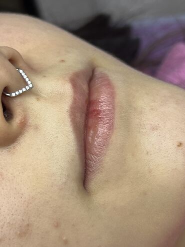 Косметология: Косметология, Ботокс, Биоревитализация, Ботулинотерапия, Консультация, Гипоаллергенные материалы, Сертифицированный косметолог — 26