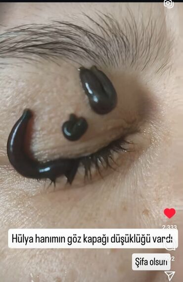 Hicama, zəli: Xidmət: Hicama, hirudoterapiya və masaj - Hicama terapiyası: Bədənin — 8