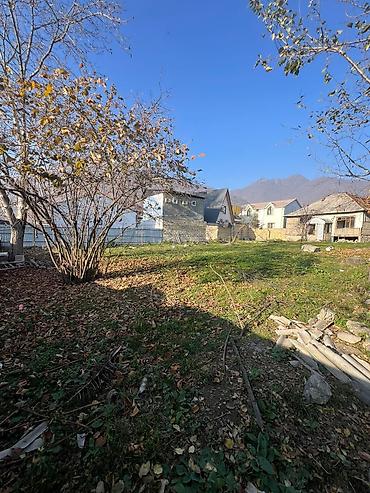 sans tibb merkezi gence: 11 sot, Tikinti, Kupça (Çıxarış) — 1