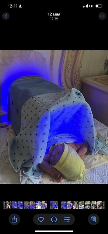 Медициналык лампалар: Фотолампа от желтушки аренда от 300-400-500сом в сутки . Консультация — 3