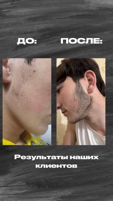 Косметика: Средство для роста волос и бороды - Назначение: усиление роста щетины — 5