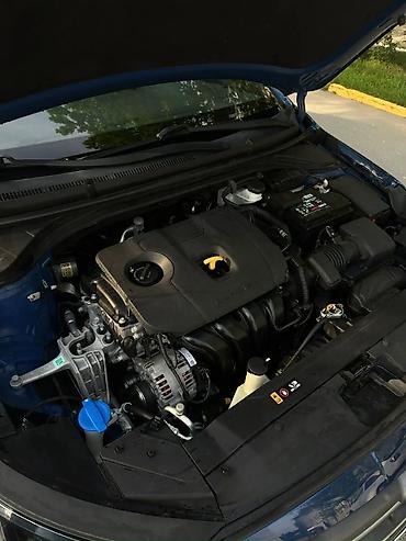 Hyundai: Hyundai Elantra: 2 l | 2020 il Sedan — 7