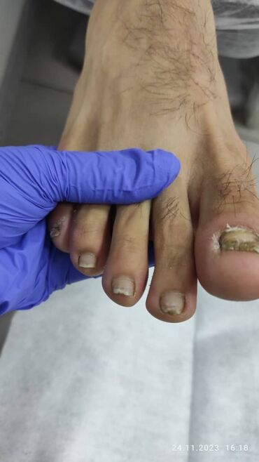 Маникюр, педикюр: Наращивание ногтей, Гель лак, шеллак, Укрепление ногтей, Услуги подолога, Маникюр, Педикюр, Консультация, Одноразовые расходные материалы — 9