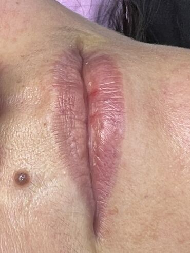 Косметология: Косметология, Маски, Мезотерапия, Удаление носогубных складок, Гипоаллергенные материалы, Консультация, Сертифицированный косметолог — 66