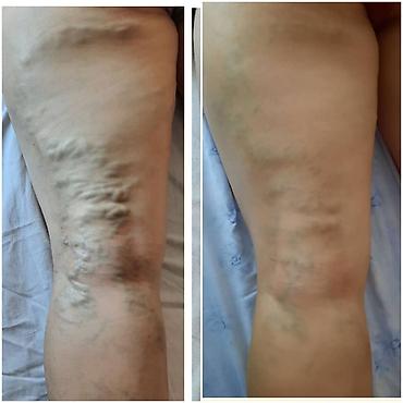 Витамины и БАДы: Питательные таблетки ГАОСЕН — натуральный продукт для поддержания — 4