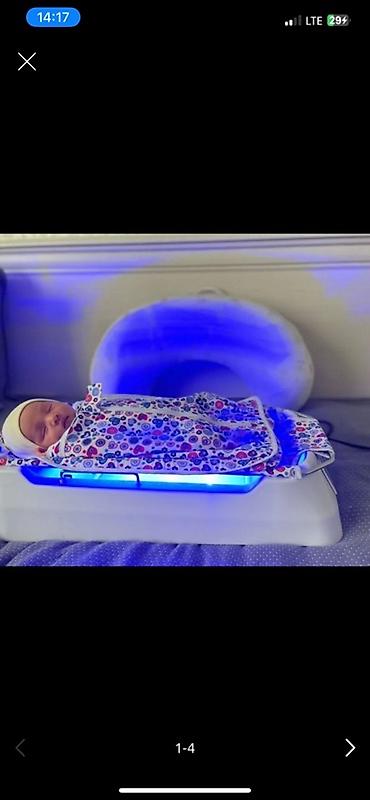 нужна: Фотолампа от желтушки аренда Фотолампа нижнего свечения — это — 1