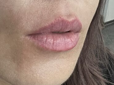 Косметология: Косметология, Маски, Мезотерапия, Удаление носогубных складок, Гипоаллергенные материалы, Консультация, Сертифицированный косметолог — 88