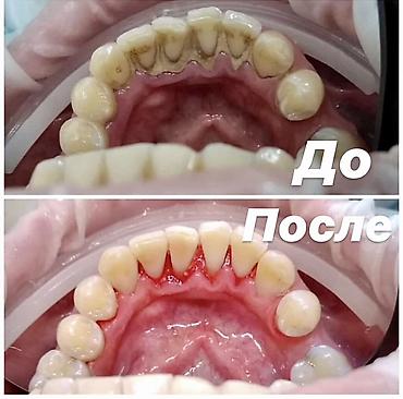 Красота и здоровье: Профессиональная гигиена полости рта (чистка зубов) Что входит: - — 6