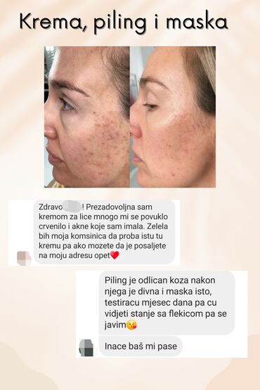 siberian wellness krema za problematičnu kožu: Set za problematicnu kozu, koji sadrzi kremu, piling i masku 🥰 Za