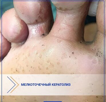 Маникюр, педикюр: Коррекция вросших ногтей, Маникюр, Педикюр, Услуги подолога, Консультация — 3