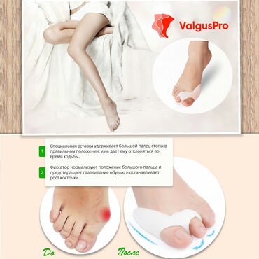 для ног: Корректоры для большого пальца ноги от вальгусной деформации(косточки