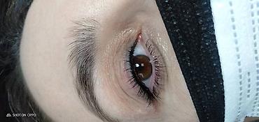 Косметология: Косметология, Ботокс, Биоревитализация, Ботулинотерапия, С выездом на дом, Консультация, Гипоаллергенные материалы — 23