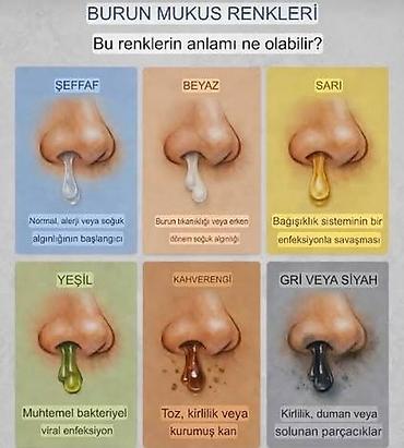 rəngli kağız: Məhsul: Burun axıntısı və selik rəngləri haqqında maarifləndirici — 2