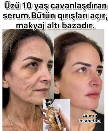 hyaluron tursusu qiymeti: Qırışları açan,üzü 10 yaş cavanlaşdıran QIZIl SERUM. ✔en derin