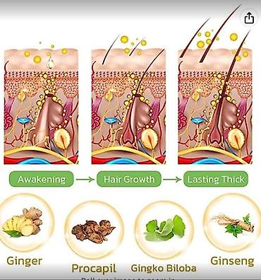 Уход за телом: США Сыворотка от облысения очень эффективная листаем фото спрей — 9