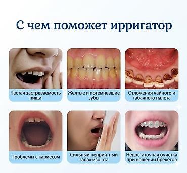 ирригатор для рта: Портативный ирригатор для полости рта - 3 режима работы: - Мягкий — — 2
