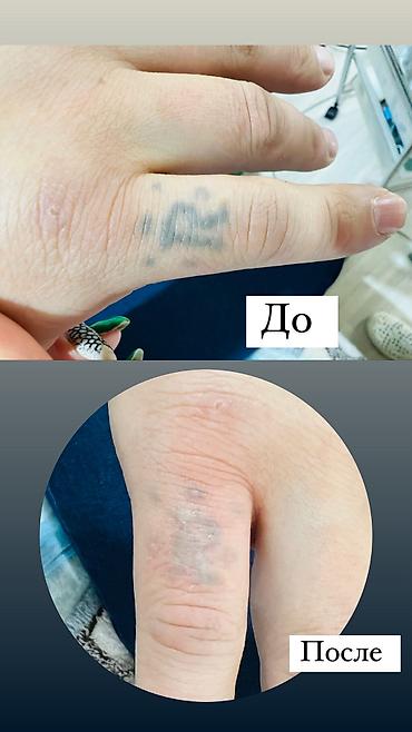 Сулуулук жана ден-соолук: ✨ Косметолог из Москвы теперь в Бишкеке! ✨ Опыт работы 5 лет — 9