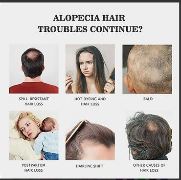 Уход за телом: США от облысения алопеции для роста волос продажа оптом и в розницу — 6