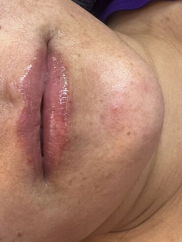 Косметология: Косметология, Маски, Мезотерапия, Удаление носогубных складок, Гипоаллергенные материалы, Консультация, Сертифицированный косметолог — 50