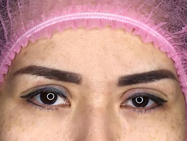 Косметология: Косметология, Ботокс, Биоревитализация, Ботулинотерапия, С выездом на дом, Консультация, Гипоаллергенные материалы — 29