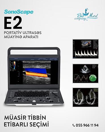 Tibbi avadanlıq: SonoScape E2: Tam Komplekt, Peşəkar Diaqnostika! Klinikanızın — 1