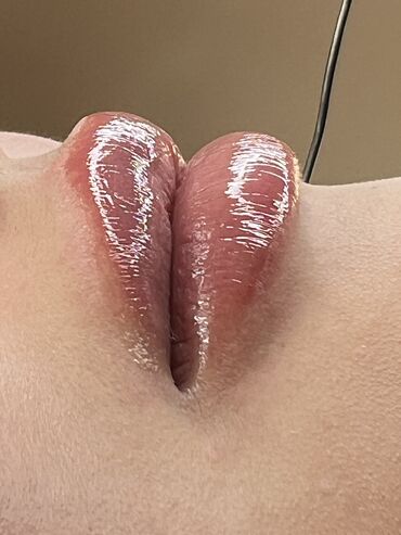 Косметология: Косметология, Ботокс, Биоревитализация, Ботулинотерапия, Консультация, Гипоаллергенные материалы, Сертифицированный косметолог — 16