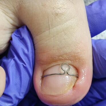 Маникюр, педикюр: Выравнивание, Наращивание ногтей, Донаращивание ногтей, Маникюр, Педикюр, Услуги подолога, С выездом на дом, Консультация, Одноразовые расходные материалы at lalafo.kg — 2 Маникюр, педикюр: Выравнивание, Наращивание ногтей, Донаращивание ногтей, Маникюр, Педикюр, Услуги подолога, С выездом на дом, Консультация, Одноразовые расходные материалы — 2