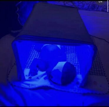 Медицинские лампы: Фотолампа Кювез . Современная фотолампа от желтушки для новорожденных
