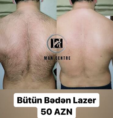 Digər gözəllik və sağlamlıq xidmətləri: Kişilər üçün Lazer Epilasiya✅ Üz,Boyun,Boğaz,Qulaq,Burun = 10 AZN — 10