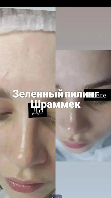 Косметология: Предлагается услуга по проведению косметических процедур, направленных — 5