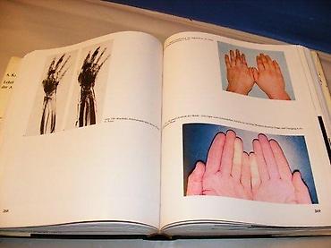 link: Lehrbuch und Atlas der Angiologie, Erkrankungen der Arterien, Venen — 2