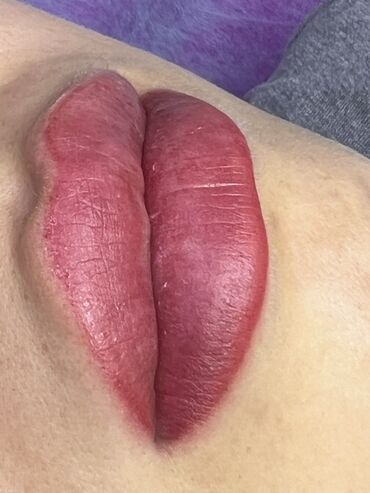 Косметология: Косметология, Маски, Мезотерапия, Удаление носогубных складок, Гипоаллергенные материалы, Консультация, Сертифицированный косметолог — 57