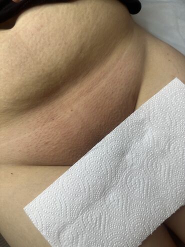 Эпиляция: Я мастер Ася 🍯 С опытом 3 года 🤝 Шугаринг Ламинирование бровей и — 10