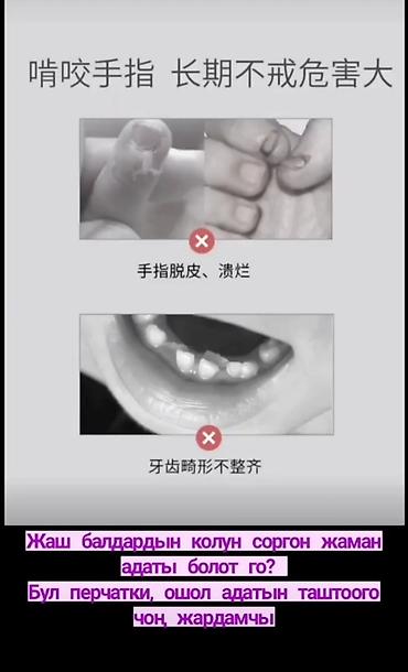 Другие принадлежности: Перчатка от сосания пальца — 7