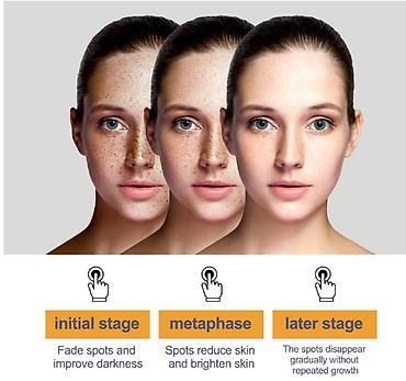 Уход за телом: ❄️ сша крем интенсивный отбеливающий антивозрастной с еbay аmazon и — 5