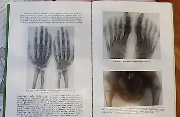 Другие книги и журналы: Рейнберг С.А. Рентгенодиагностика заболеваний костей и суставов. В — 8