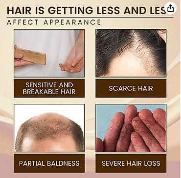 Уход за телом: ❄️ сша с аmazon сыворотка для лечения волос от выпадения волос от — 7