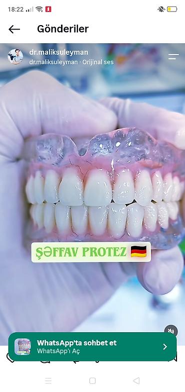 алмазная мозаика купить в баку: Protezlerin yenilenmesi Pasientlərimizə rahat və allergik olmayan — 1